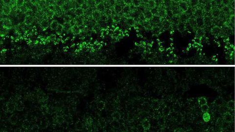 Preventing Loss of Vision with CRISPR