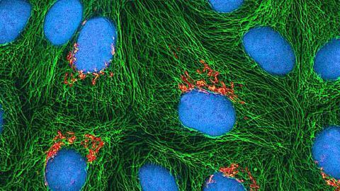Scottish Universities Collaborate to Develop New Drugs for Tissue Repair