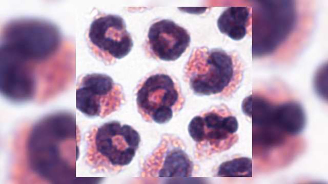 White Blood Cells Prevent Diabetes and Hypertension