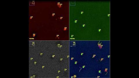 Cellular Jet-lag Promotes Diabetes