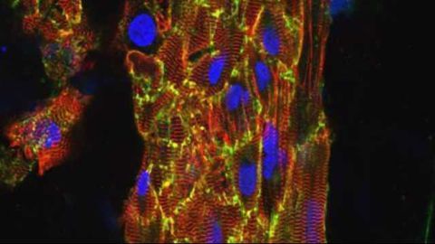 'Beating' Heart Created from Stem Cells