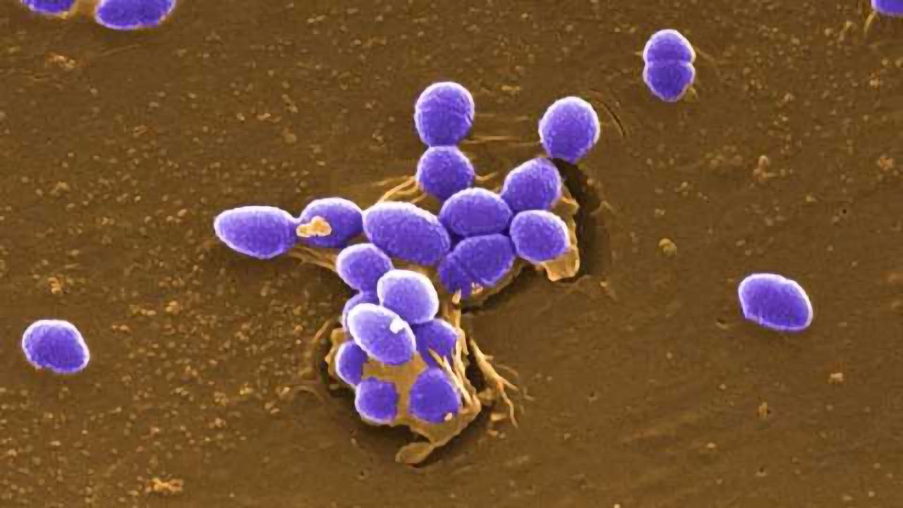 Rapid, Accurate Analysis of Gram Positive Bacterial Stressor Responses