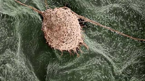 Using Plants as 3-D Scaffolds for Tissue Engineering