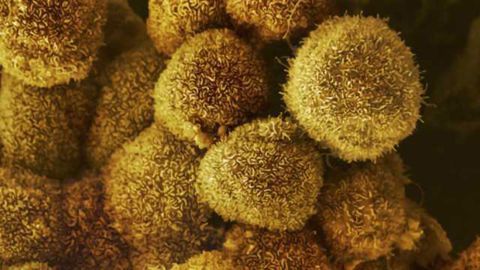 Novel Cancer Suppressing Genes Identified