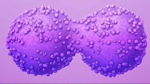 The Key to Drug Resistant Breast Cancer