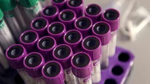 Identifying Cancer Type from a Single Blood Test