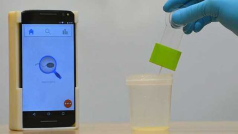 Smartphone-based Assay Enables Point-of-care Diagnosis of Sperm Abnormalities