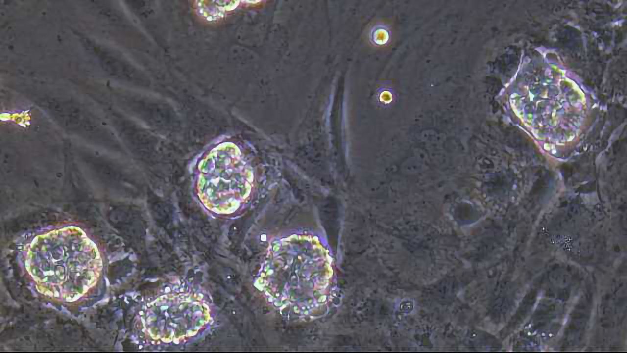 Simplified Production of Human Brain and Muscle Cells