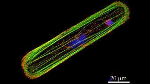 Measuring Heart Toxicity of Cancer Drugs