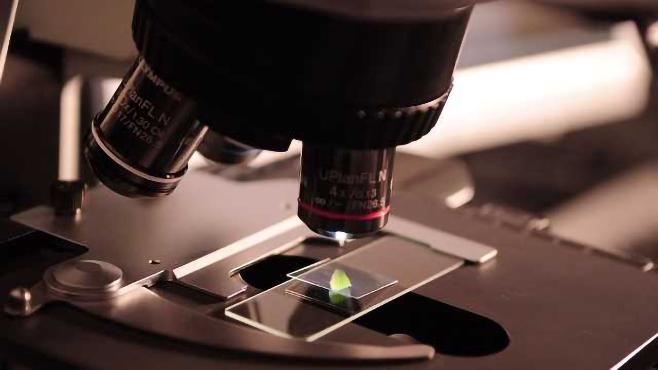 Gene Associated with Tau Pathology