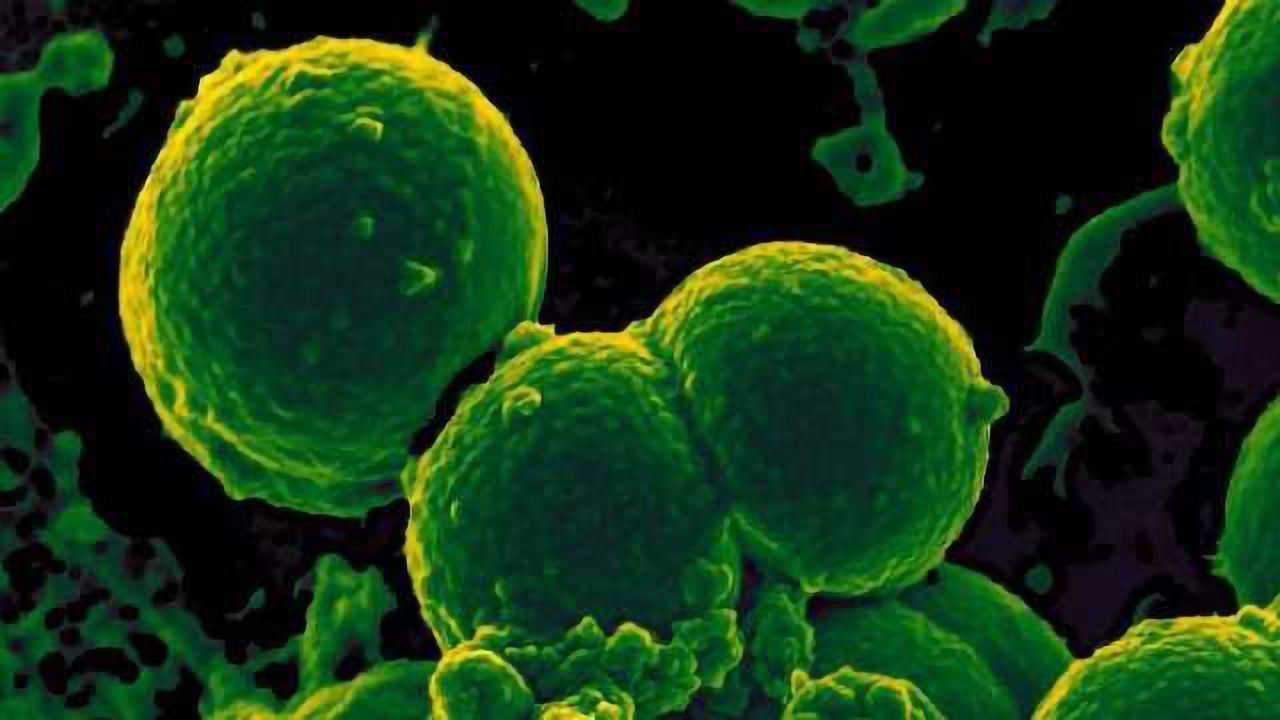 Antimicrobial Resistance Diagnostic Challenge Selects 10 Semifinalists