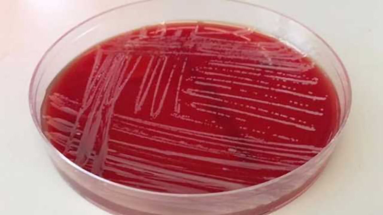 Revealing the Mysteries of Hard-to-treat Bacterial Infection in Cystic Fibrosis