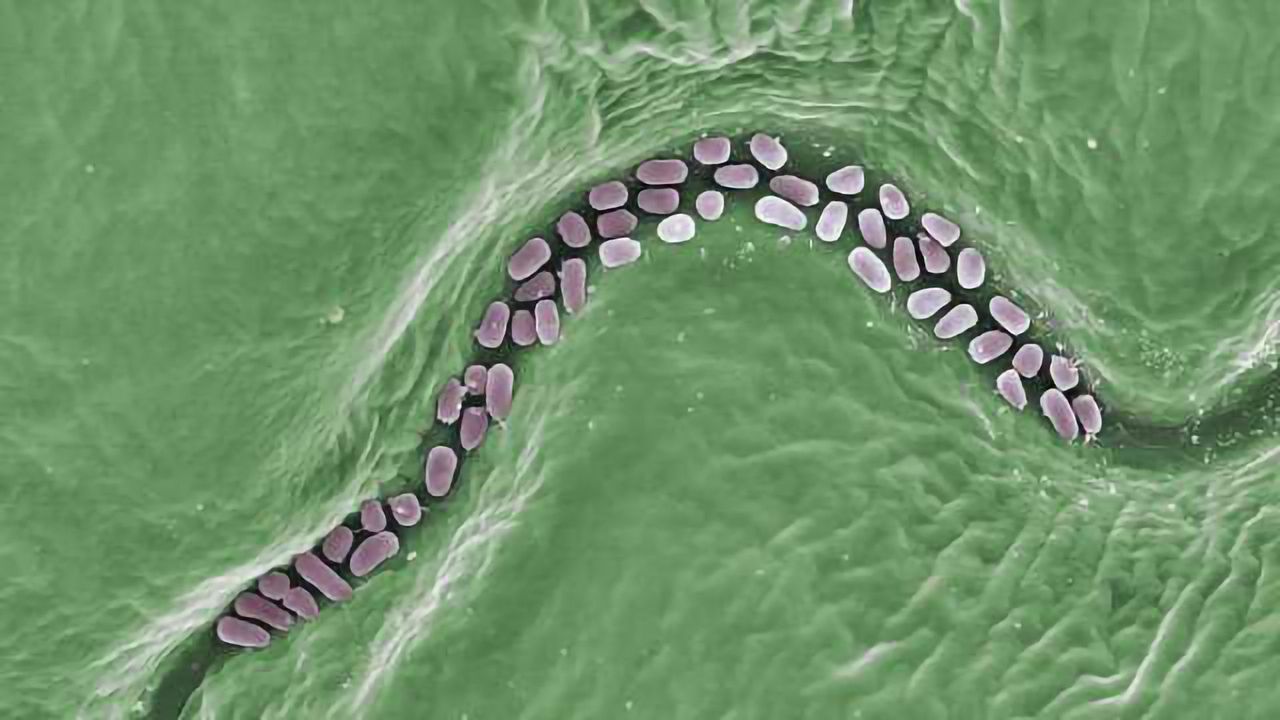 A 5 Point Plan for Agricultural Microbiome Research