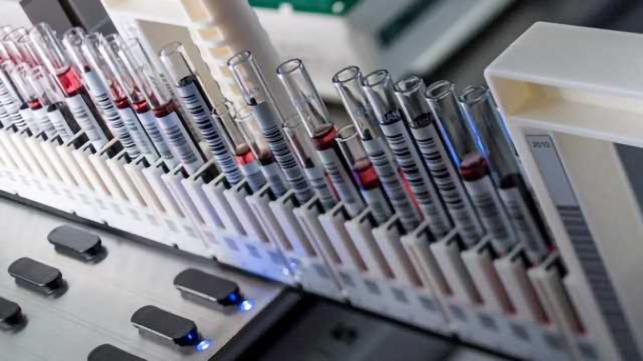 Enhance Your Workflow Efficiency with Rapid Tube Identification