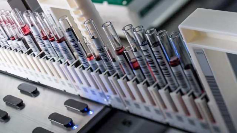 Enhance Your Workflow Efficiency with Rapid Tube Identification content piece image