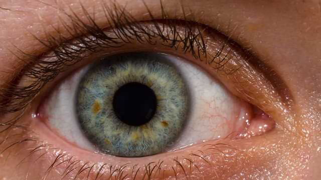 3 Genes Linked to Progressively Blinding Eye Disease