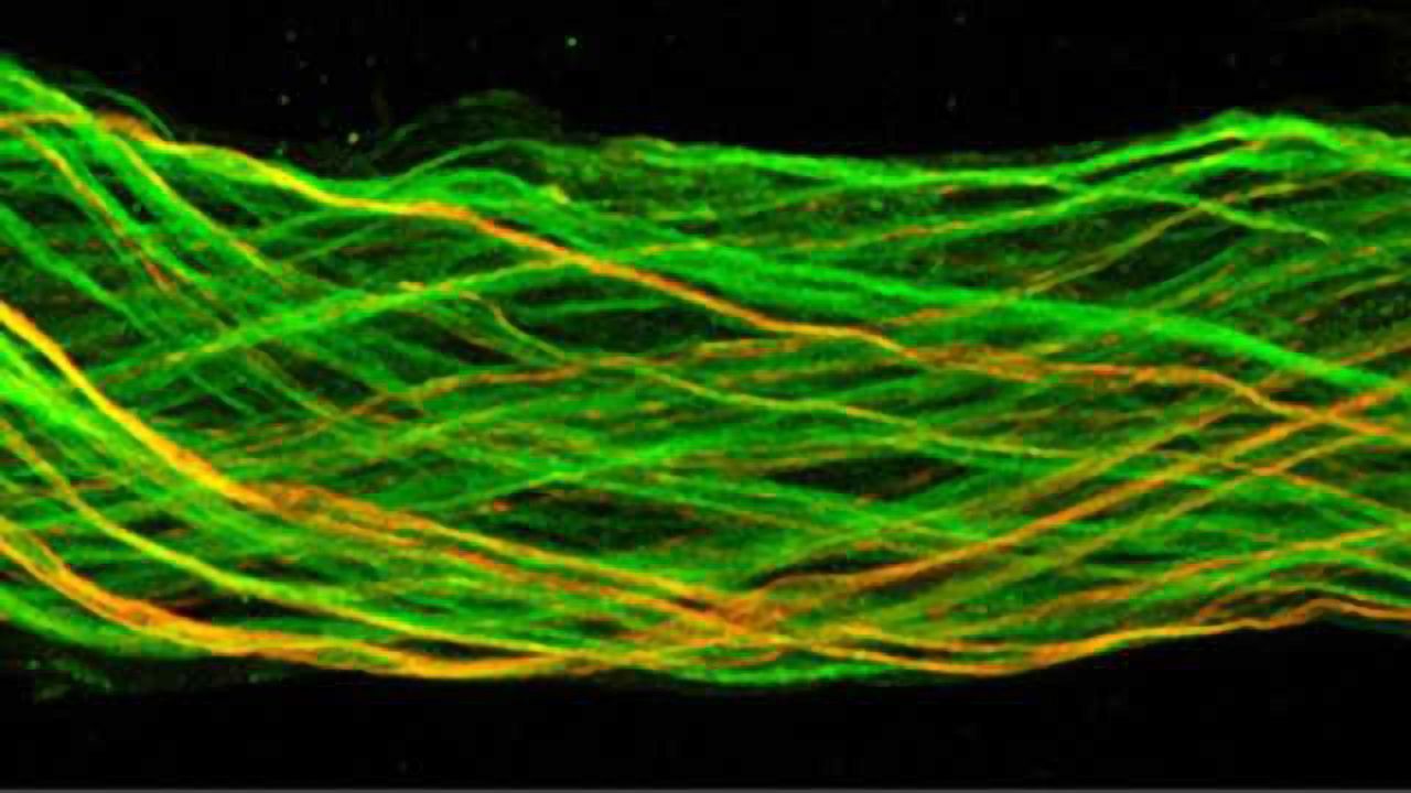 Absence of Peripheral Neurons Triggers Obesity