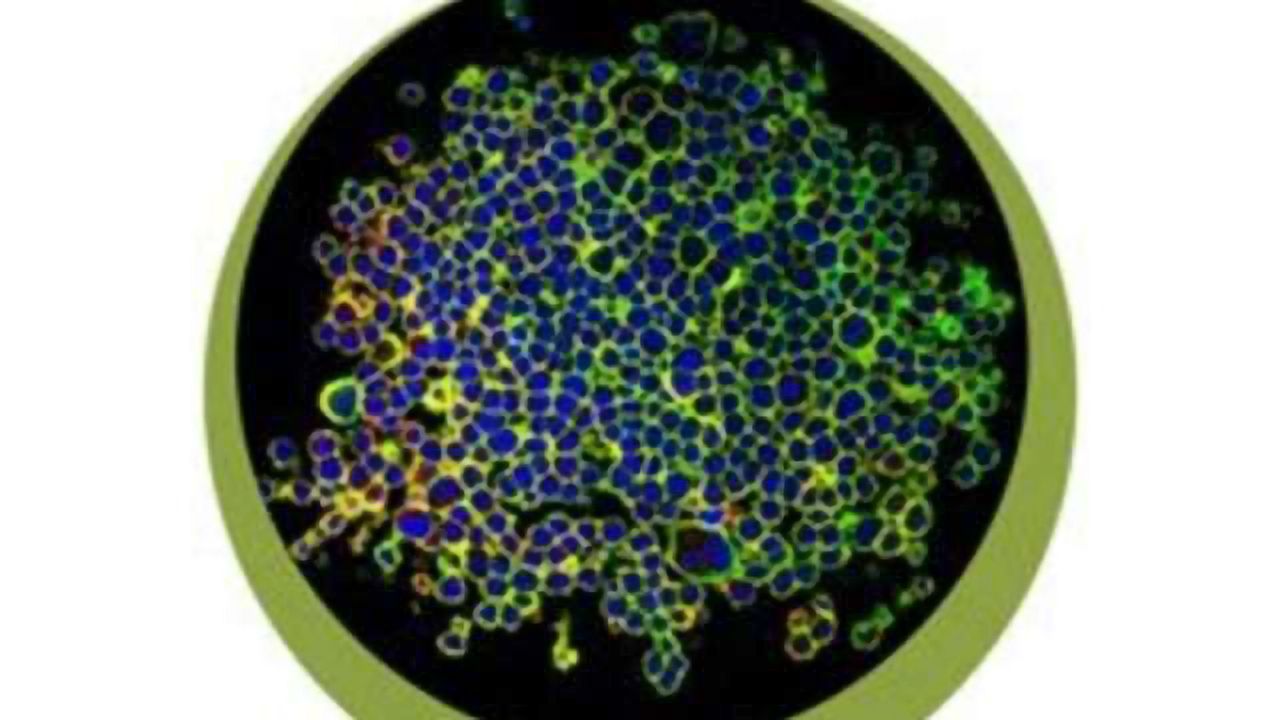 Novel 3D Cell-based Assays Accelerate Discovery for Immuno-oncology/CAR-T Therapies