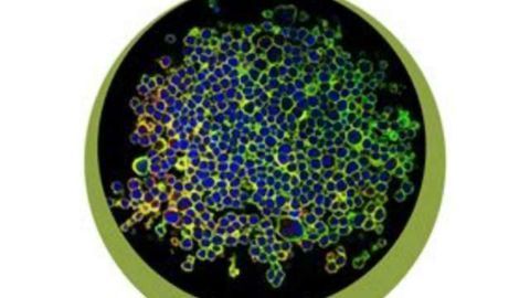 Novel 3D Cell-based Assays Accelerate Discovery for Immuno-oncology/CAR-T Therapies