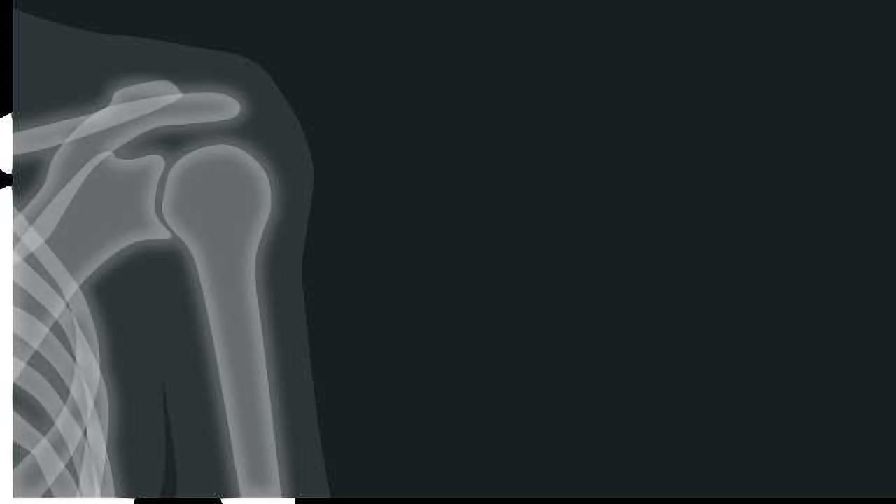 Regenerating Rotator Cuffs with Stem Cells