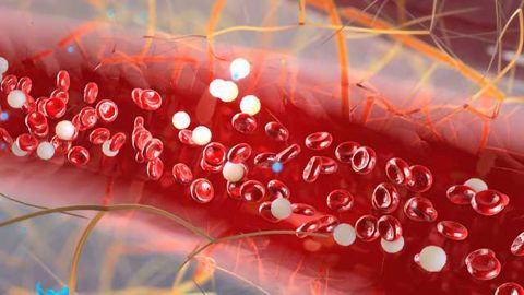 Microfluidic Device Detects Circulating Plasma Cells