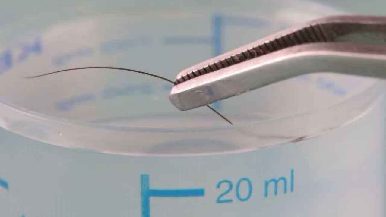 Hair Testing Shows High Use of Psychoactive Substances