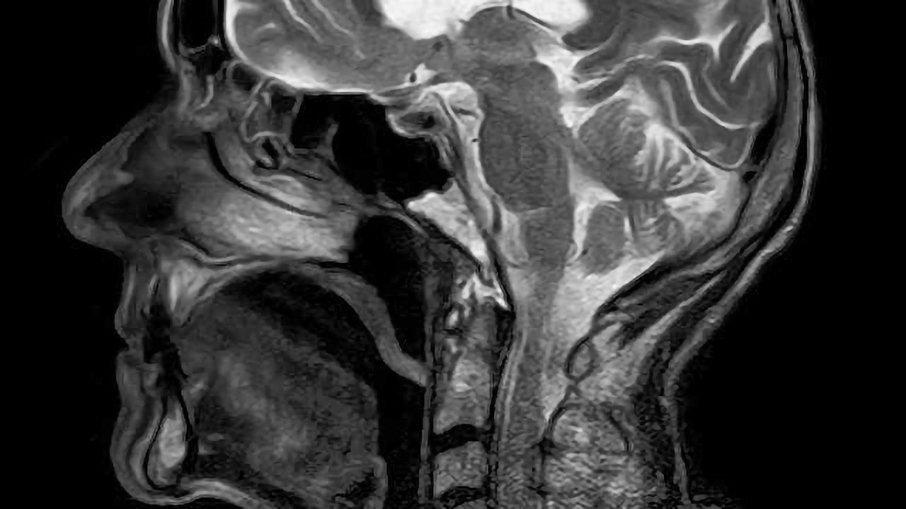 New Technique Enhances the Diagnostic Ability of MRI