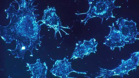 A Gene that's Driving Cancer Drug Resistance