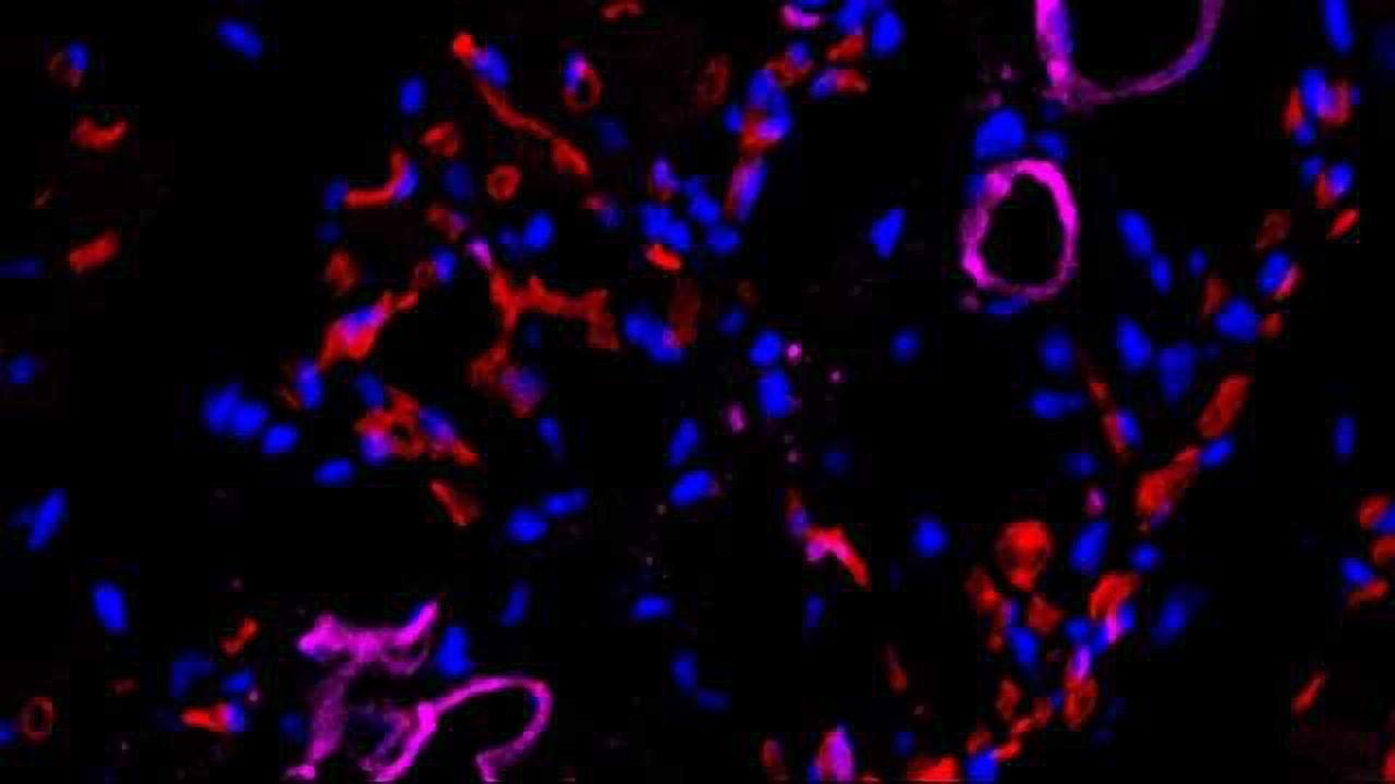 Partial De-differentiation Converts Skin Cells into Blood Vessel Cells