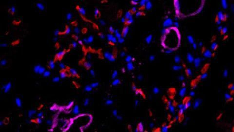 Partial De-differentiation Converts Skin Cells into Blood Vessel Cells