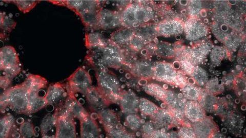 An Atlas of Gene Expression for the Liver
