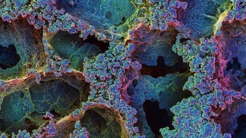 Setting a Trap for Autoimmunity