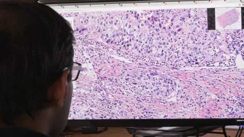 Philips, PathAI Collaborate