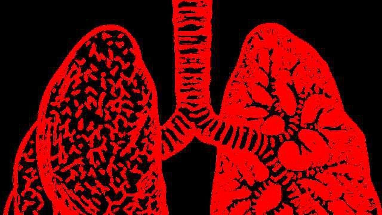 New Imaging Technique Measures Cystic Fibrosis Drug's Effectiveness