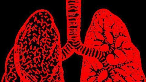 New Imaging Technique Measures Cystic Fibrosis Drug's Effectiveness