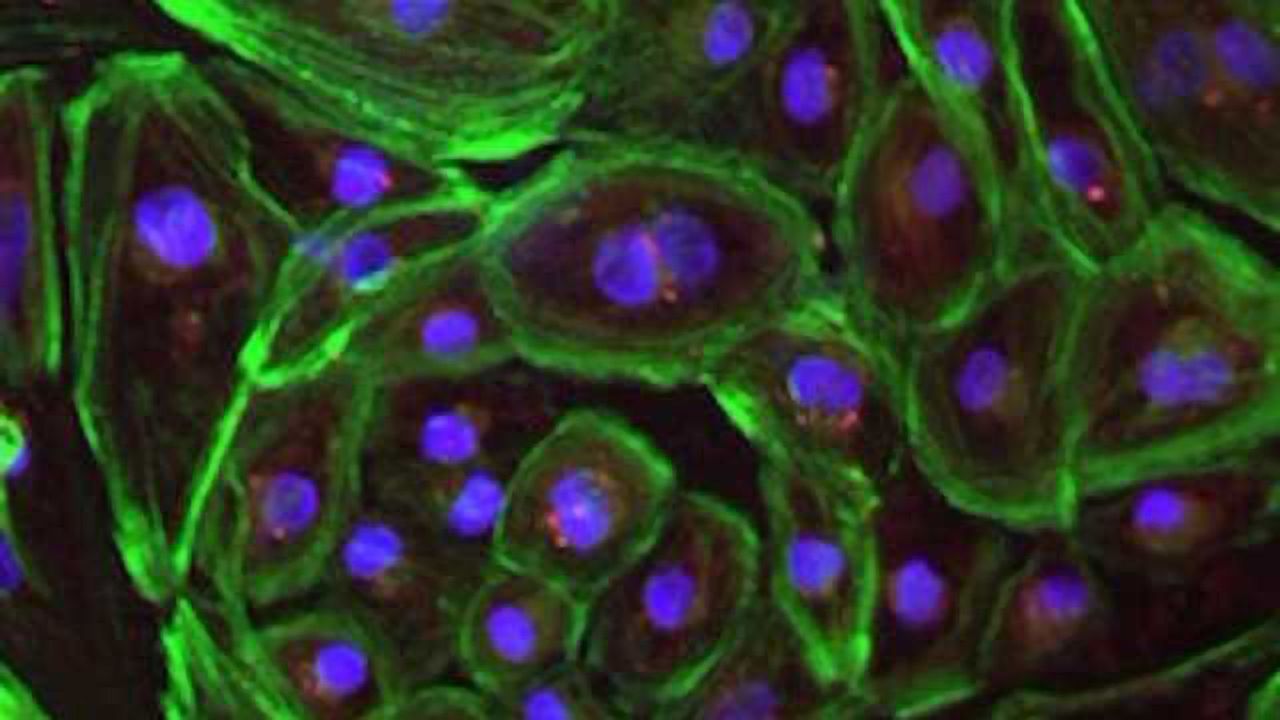 New Version of CRISPR Successfully Repairs Defects in Duchenne Muscular Dystrophy