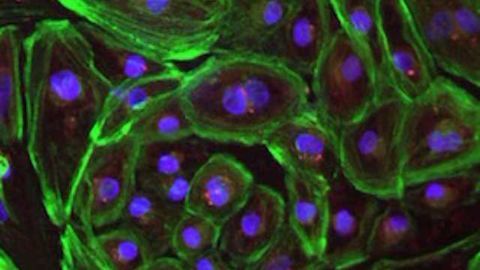 New Version of CRISPR Successfully Repairs Defects in Duchenne Muscular Dystrophy