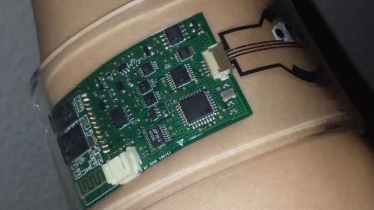 Diagnosing Diseases With A Wearable Sweat Sensor