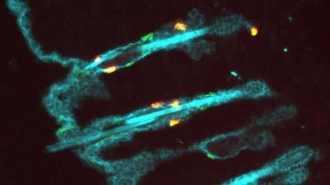 Resident Memory T Cells Protect Against Future Cancers