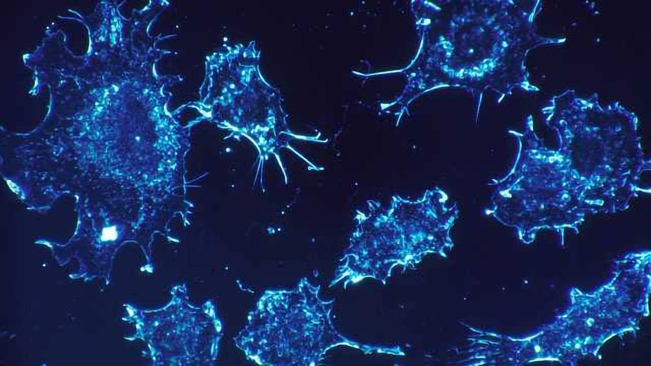 Are Tumor Cells Really Addicted to Glutamine?