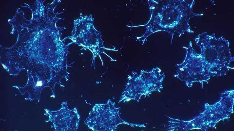Are Tumor Cells Really Addicted to Glutamine?