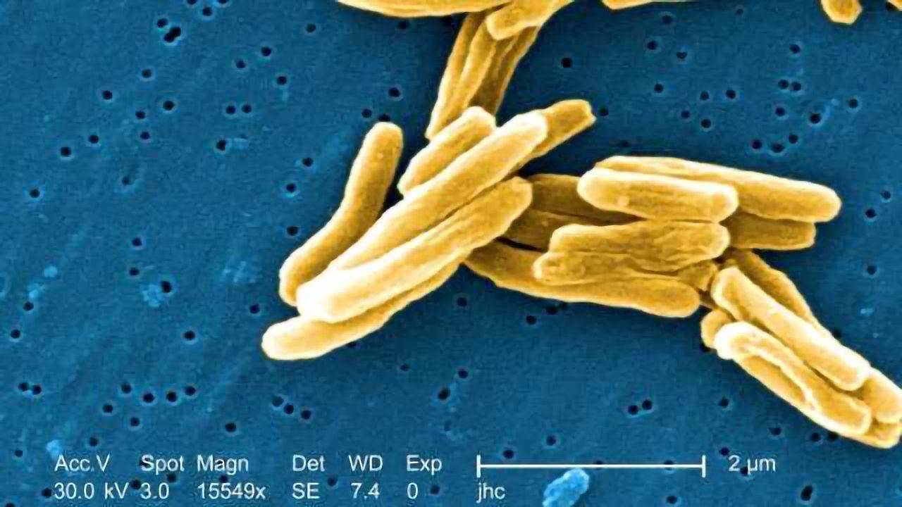 Building Tools to Support TB Research
