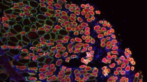 Alerting Stem Cells to Respond to Injury