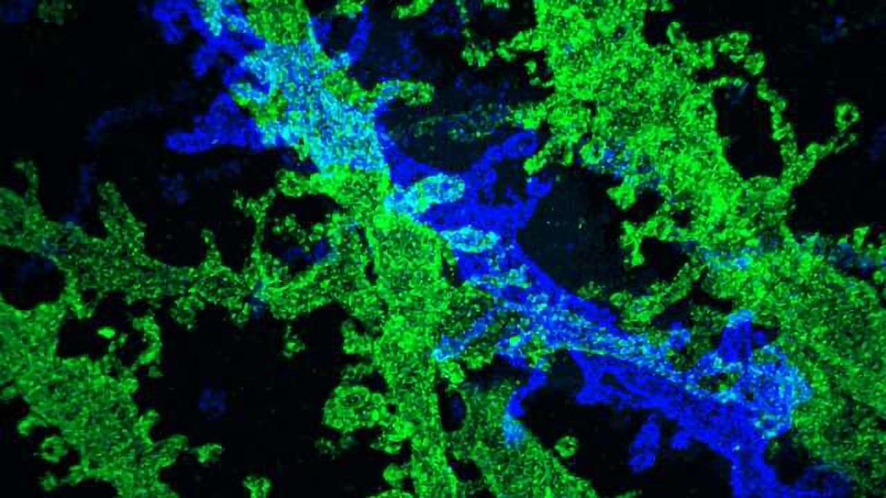 High-Resolution Imaging with Conventional Microscopes
