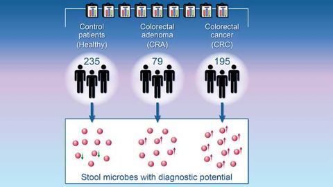 Microbial Markers Could Help Diagnose Colorectal Cancer
