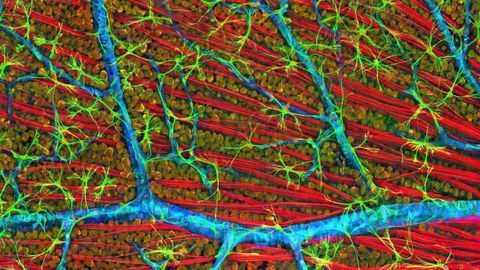 Reversing Gene Damage to Treat Blindness
