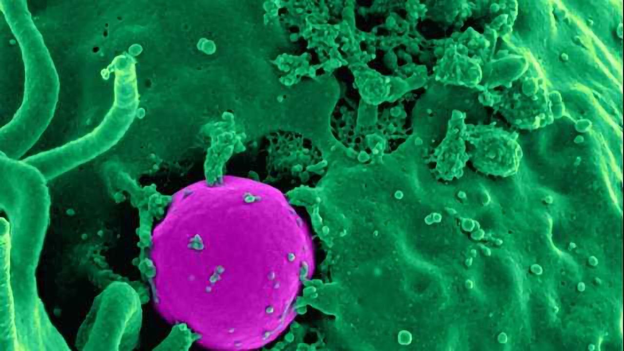 Ingestible Sensors Could Help Diagnose Gut Disorders