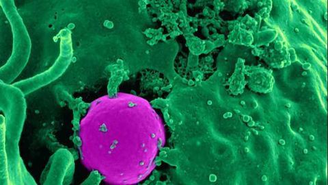 Ingestible Sensors Could Help Diagnose Gut Disorders