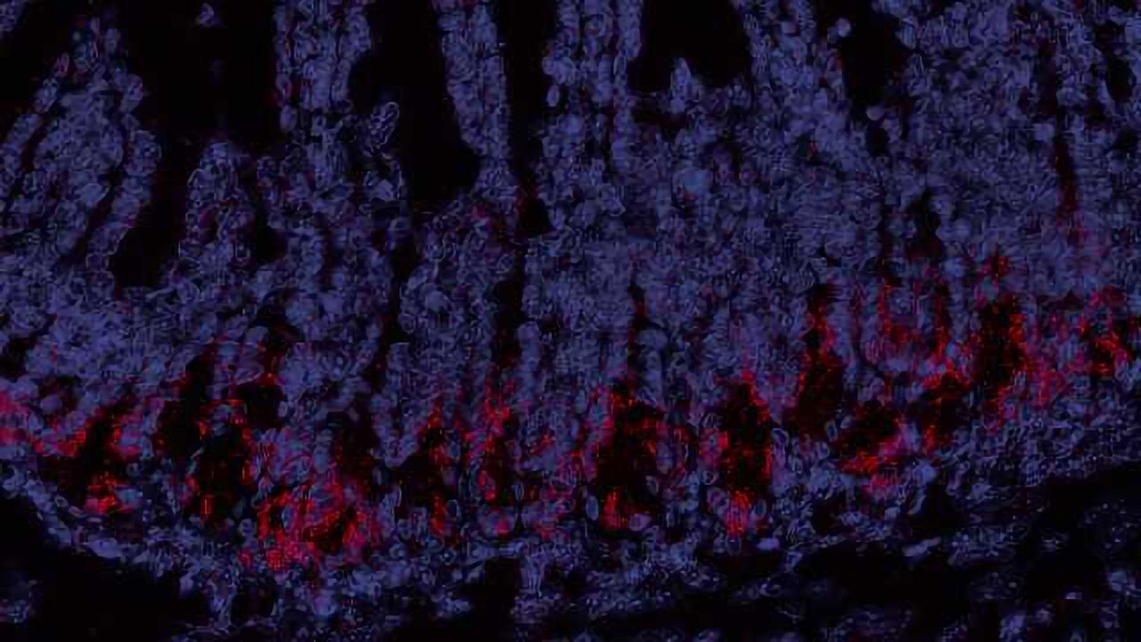 Protecting the Gut Could be Key in Preventing Graft-Versus-Host Disease