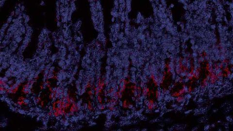Protecting the Gut Could be Key in Preventing Graft-Versus-Host Disease